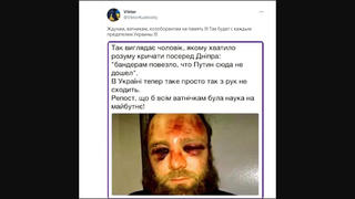 Перевірка факту: Фото людини з синцями НЕ зображає чоловіка, побитого в Дніпрі за вигуки про Путіна